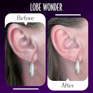 ear lobe